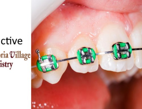 What is a Dental Adjunctive Procedure?