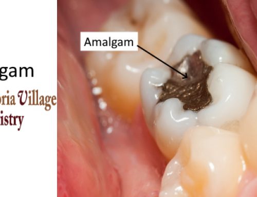 What is the Definition of Amalgam?